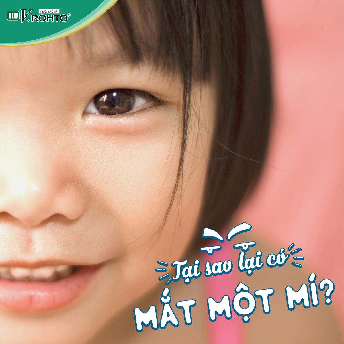Tại sao lại có mắt một mí?